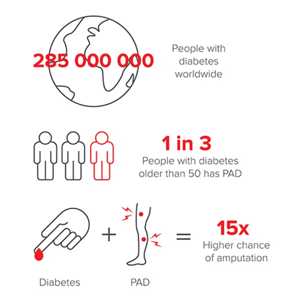 Peripheral-Arterial-Disease-and-Diabetes