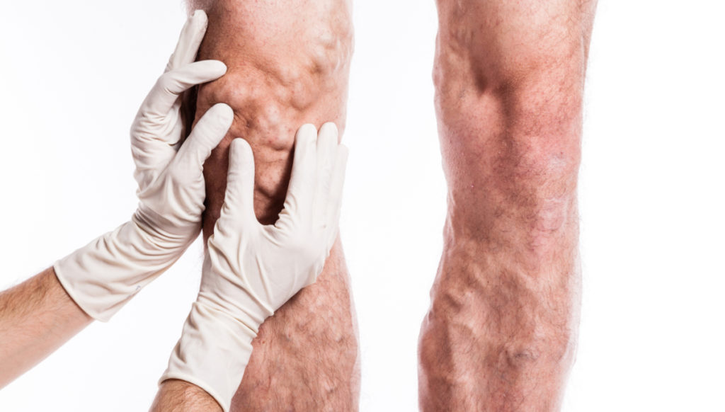 Why-preventive-check-ups-can-save-a-patient's-life